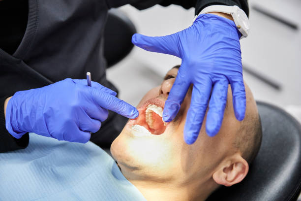 Best Emergency Cosmetic Dentistry in King City, OR